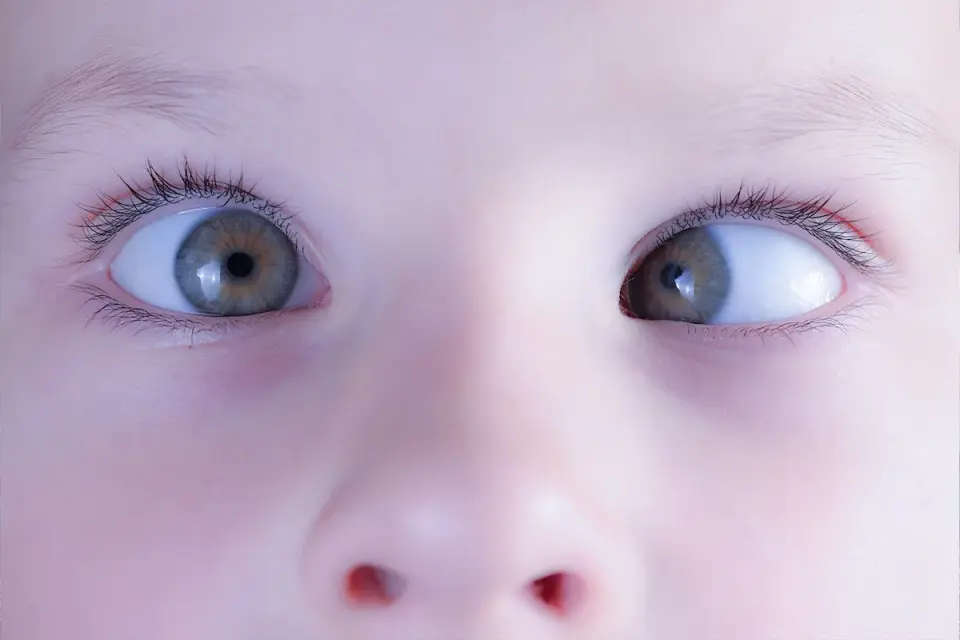 Zez - Leczenie, objawy i diagnostyka. Poradnik NFZ